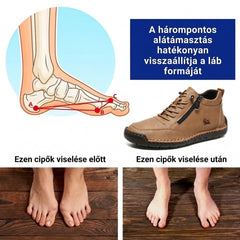 ⏰ Féláras ajánlat – csak ma! 🔥 | Kiváló minőségű, valódi bőr ortopéd cipő | Megtámasztja a lábboltozatot, enyhíti a fájdalmat és megkönnyíti a járást | Uniszex.